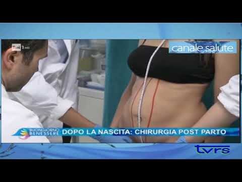 Intervento per Diastasi Addominale: Prezzi e Opzioni Disponibili