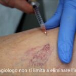 Frenulo rotto: Cosa fare per una guarigione ottimale