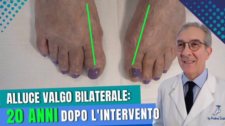 Alluce Valgo: Dolore Post-Operativo e Soluzioni