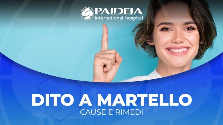 Esercizi Efficaci per Dita a Martello