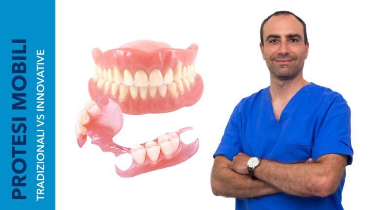 Ponti Mobili per Denti: Soluzioni Innovative per la Salute Orale
