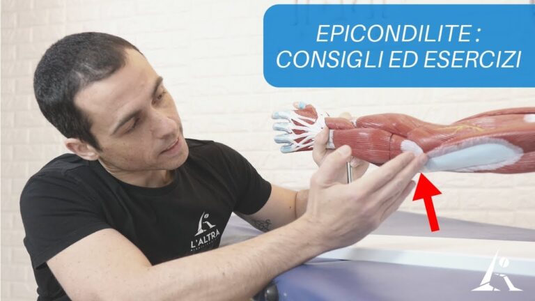 Cure Efficaci per l’Epicondilite del Gomito