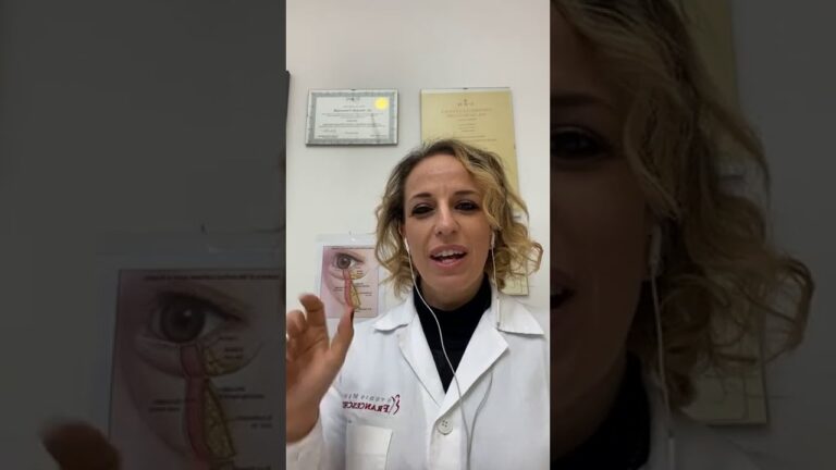 Rimedi Efficaci per le Rossori Sotto gli Occhi