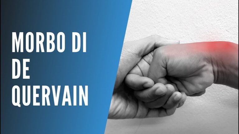 Rimedi per il Dolore al Polso Lato Pollice