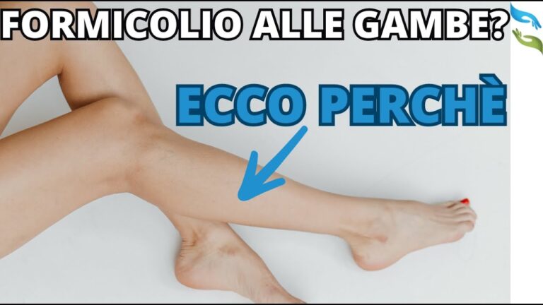 Causе e Rimedi per il Formicolio alle Gambe