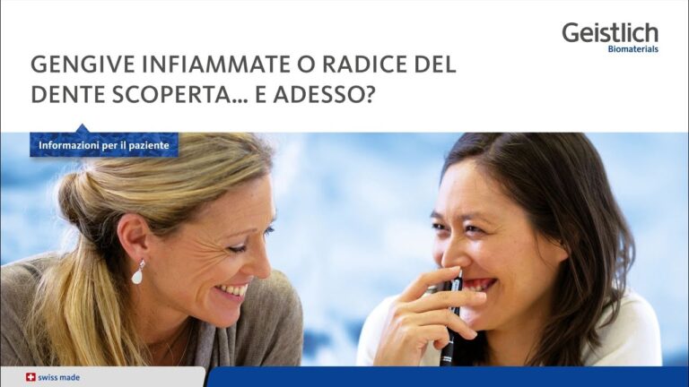 Scoperte Sulle Radici dei Denti
