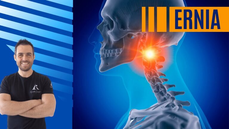 Cure Efficaci per le Ernie Cervicali