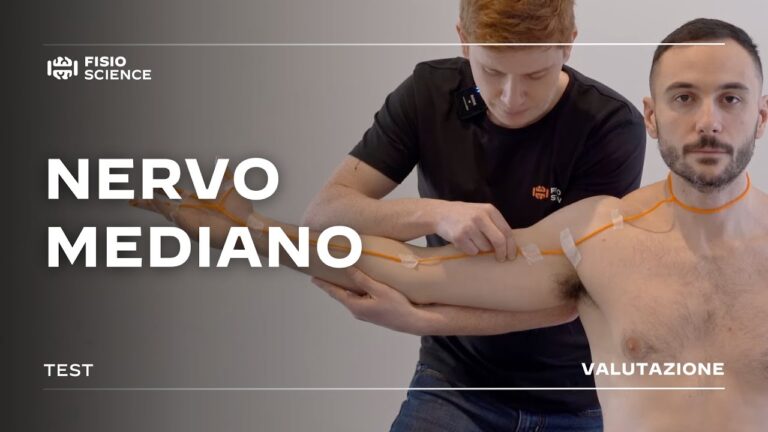 Infiammazione del Nervo Mediano: Cause e Rimedi