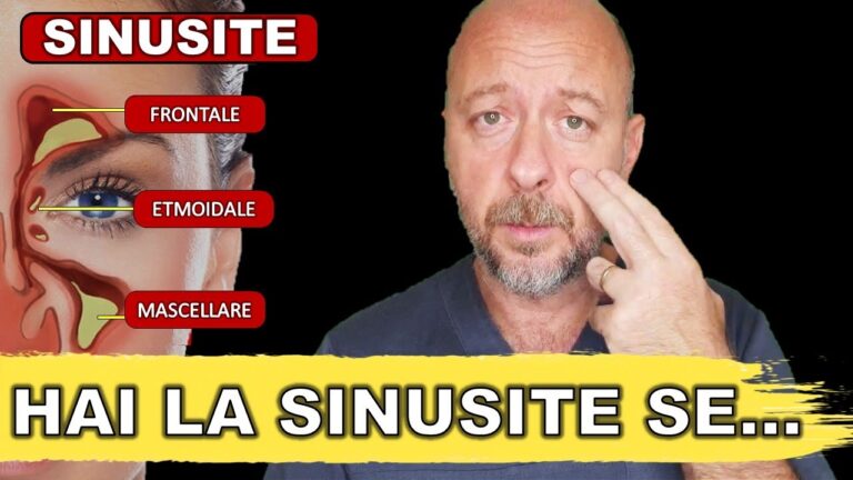 Sinusite e Sbandamenti: Cause e Rimedi Efficaci