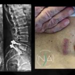 Milesax compresse: la soluzione rivoluzionaria per il benessere fisico in sole 70 caratteri!