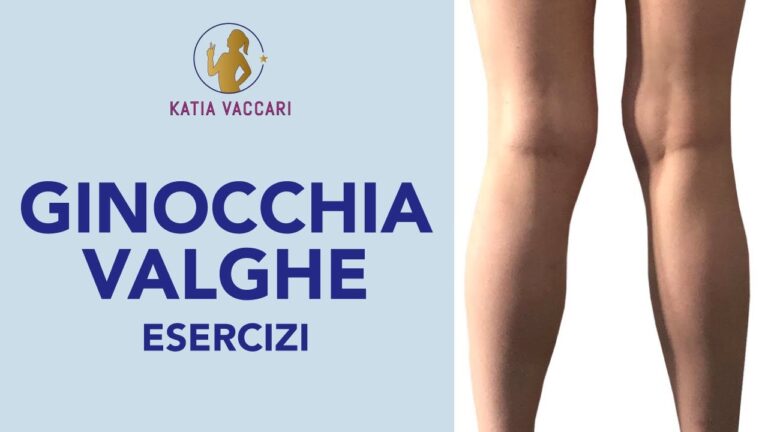 Esercizi da Evitare per le Ginocchia Valghe
