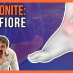 Recensioni sulla Clinica Pederzoli: Esperienze e Opinioni