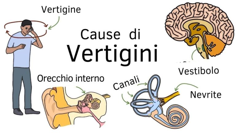 Come Superare il Giramento di Testa Efficamente