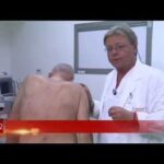 Trasformazione del viso: peeling prima e dopo