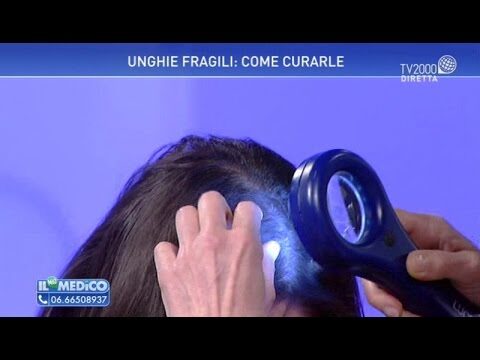Vitamina Essenziale per Prevenire la Caduta dei Capelli