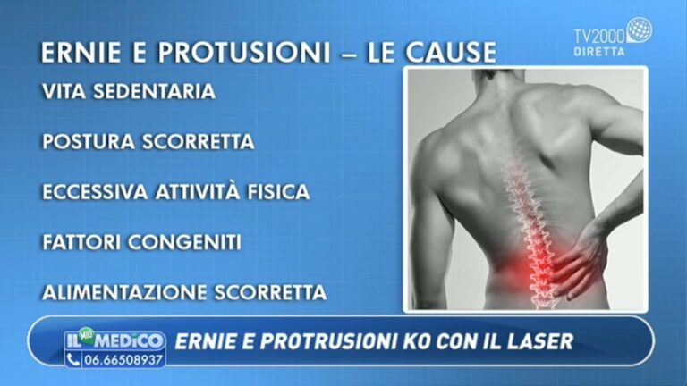Opinioni sulla Laserterapia per l’Ernia del Disco