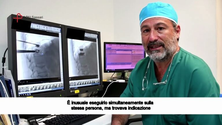 Vertebra Crollata: Cause, Sintomi e Trattamenti Efficaci