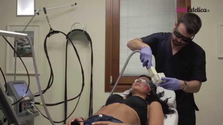 Recensioni sul Laser Alessandrite: Efficacia e Opinioni