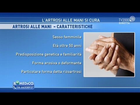 Cure Efficaci per l’Artrosi alle Mani