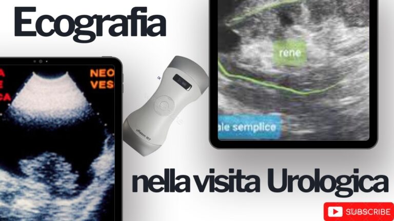 Vescica Poco Distesa: Cause e Rimedi Efficaci