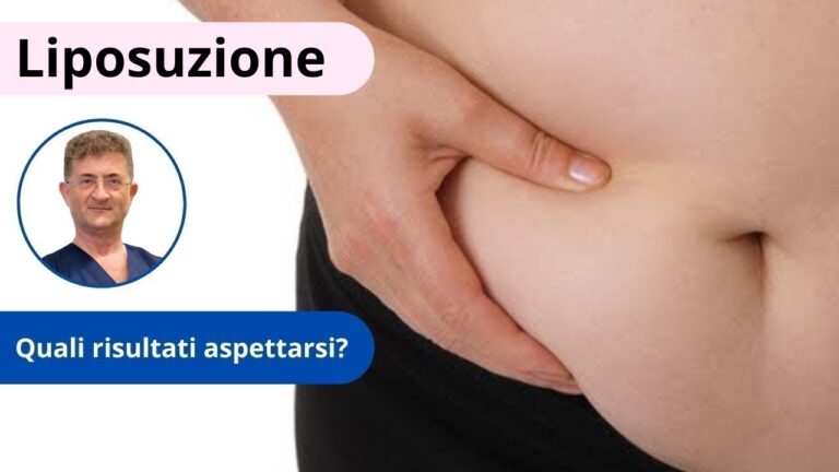 Risultati della Liposuzione Fianchi: Prima e Dopo