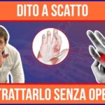 Polipo Anale Esterno: Cause, Sintomi e Trattamento