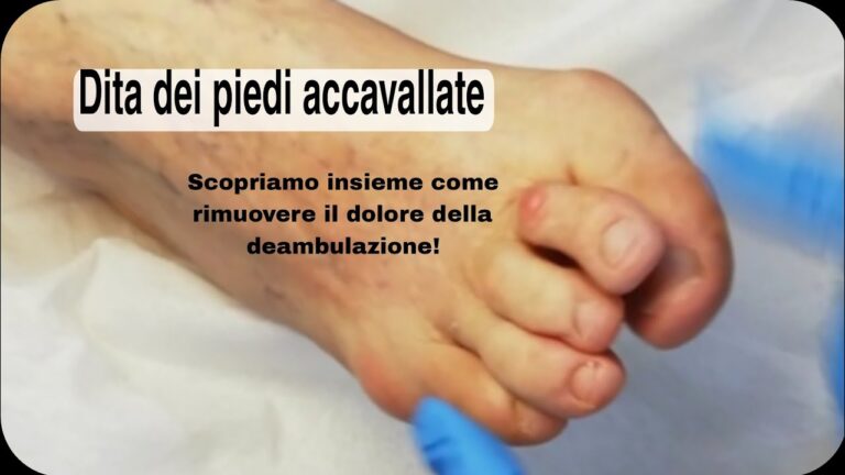 Raddrizza Dita Piedi: Soluzioni Farmaceutiche Efficaci