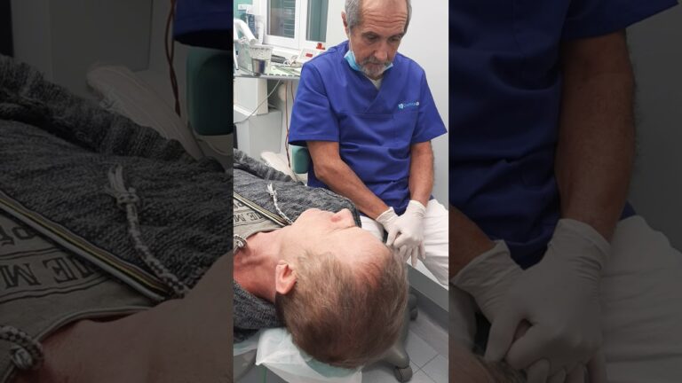 Bite: Quando Iniziano a Farsi Sentire gli Effetti?