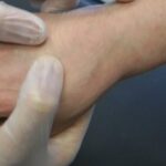 Perdita di Capelli nei Neonati: Cause e Soluzioni