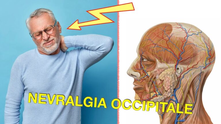 Sintomi del Nervo Occipitale Infiammato