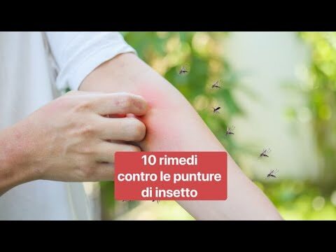 Rimedi della Nonna per le Punte degli Insetti