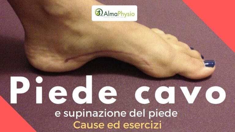 Esercizi Efficaci per il Piede Supinato