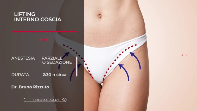 I migliori trattamenti per la lassità cutanea delle gambe
