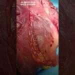 Trasformazione del viso: peeling prima e dopo
