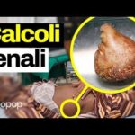 Cattiva Circolazione delle Gambe: Cause e Rimedi Efficaci