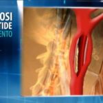 Pasta Senza Glutine Conad: Gustosa e Accessibile