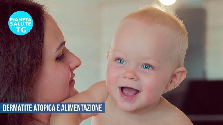 Dermatite Atopica nei Bambini: Alimenti da Evitare