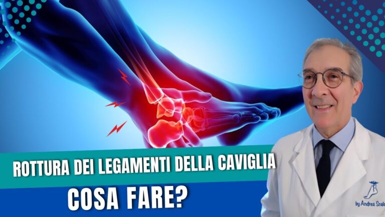 Comprendere e Trattare le Lesioni dei Legamenti della Caviglia