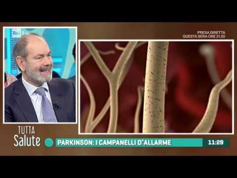 Comprendere la Mortalità nel Morbo di Parkinson