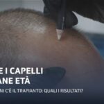 I benefici del t&egrave; verde sull’intestino
