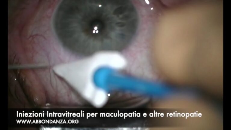 Iniezioni Intravitreali: Soluzioni per il Recupero della Vista