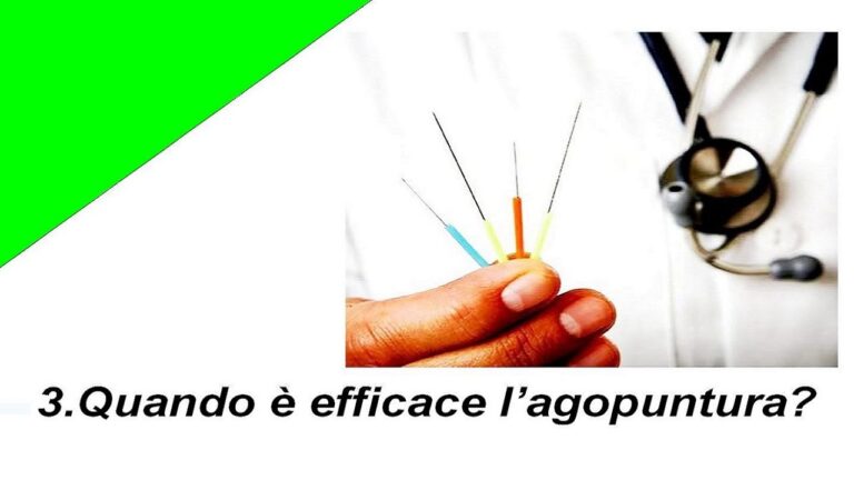Effetti dell’Agopuntura: Quante Sedute Necessarie?