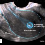 Segreti per Labbra Perfette