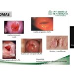Debridat 150 mg: scopri il prezzo vantaggioso per contrastare il mal di stomaco!