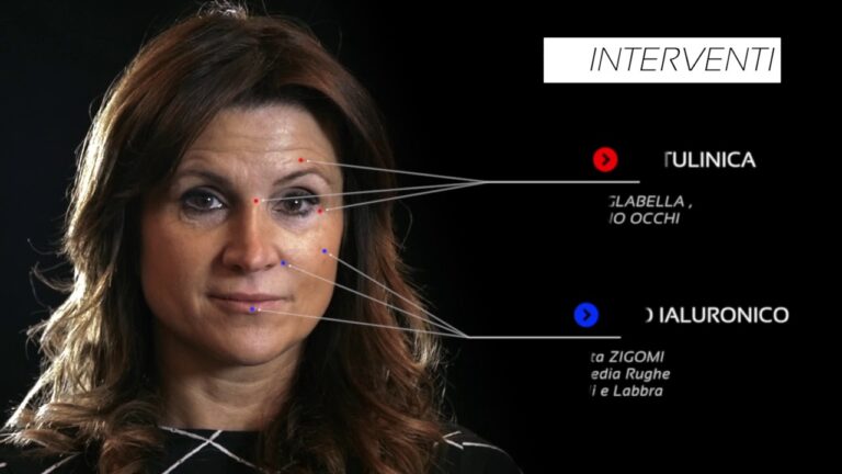 Risultati dell’Acido Ialuronico sul Viso: Prima e Dopo