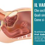 Proteine per aumentare di peso