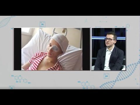 Tempi di Recupero Dopo Intervento per Neurinoma Acustico