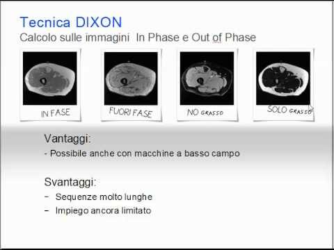 Cosa Significa L’Alterazione di Segnale?