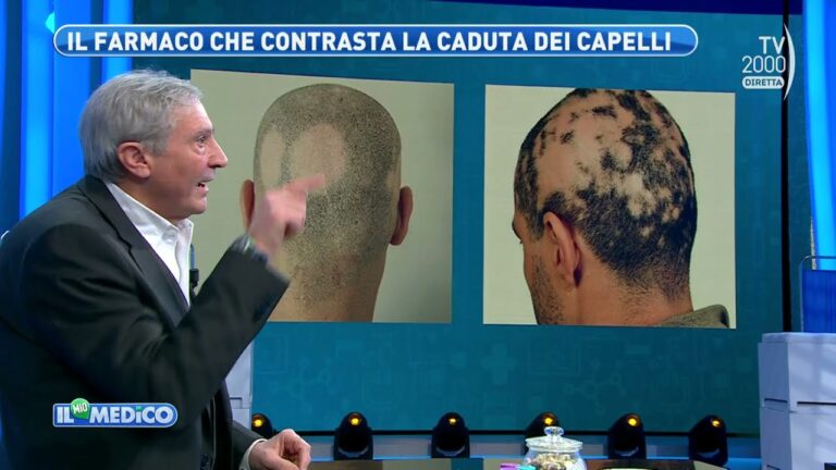 Farmaci e Perdita dei Capelli: Cosa Sapere