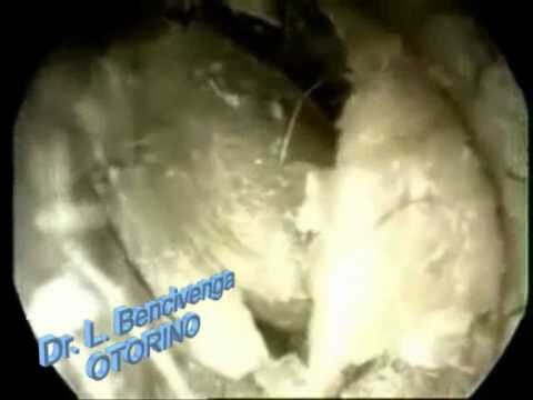 Dermatite dell’Orecchio Esterno: Cause e Rimedi